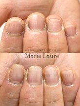 マリーロール 淀屋橋本店(Marie Laure)/自爪育成/深爪矯正/ネイルケア