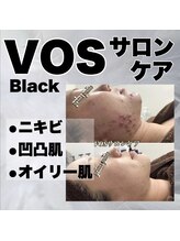 プリマプリート 島店/VOSサロンケア