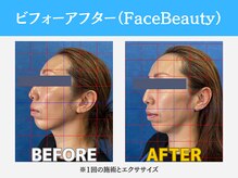 キャリッジスポーツ 盛岡(Carriage Sports)/ビフォーアフター【小顔】