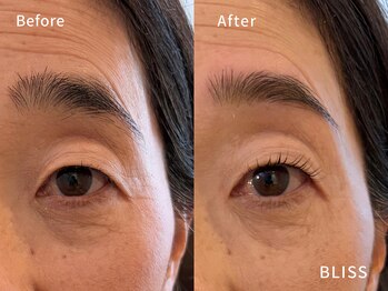 ブリス 鎌倉(BLISS)/眉毛&まつ毛セットメニュー