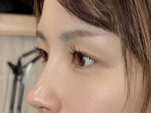 ロイル コア ビューティー(Loeyle core beauty)/横顔も自然に、品よく