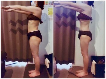 パーフェクトボディプレミアム 札幌大通店(PERFECT BODY PREMIUM)/お客様　ビフォーアフター（5）