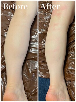 サロン ジジ(salon JiJi)/スリムムーブ痩身☆