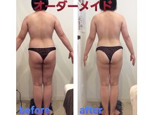 ミエル(Miel)/Before After