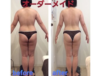 ミエル(Miel)/Before After