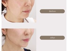 ムーンライズ(moonrise)/