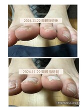 ブロックファイブハナ(Block 5 HANA)/