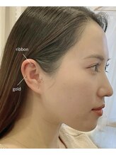 クオルーチェ(CuoLuce)/耳つぼJewelry
