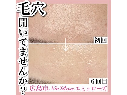 エミュローズ 段原店(Nm' Rose)の写真