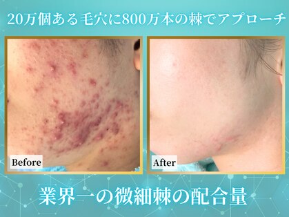 リメイククリニカルビューティー(Remake clinical beauty)の写真