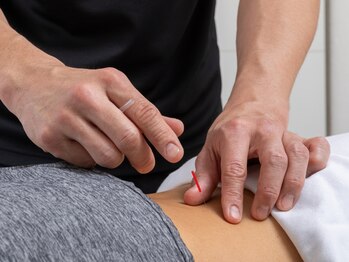 スポーツ整体院 オーシーラボ(O.C.Labo)の写真/慢性的な腰痛・肩こりに悩む方へ!国家資格者による鍼灸×整体で、根本から整える本格ケアを体験◎