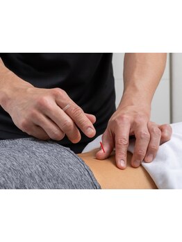 鍼灸施術を受けたい
