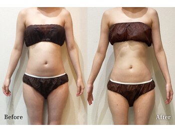 アネル うるま店(anel)/