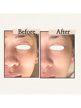 ハーティー(Hearty)/