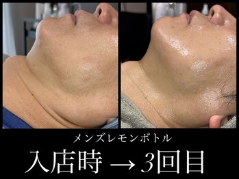 ビーエルティー(blt)/メンズレモンボトル