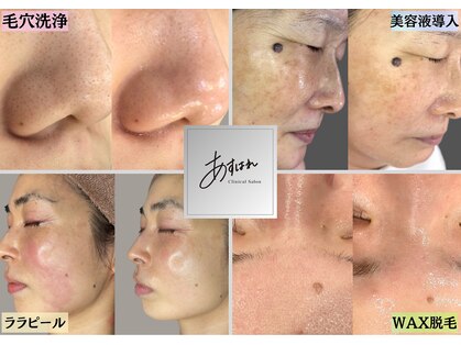 あすはれの写真