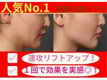 ムーンライズ(moonrise)