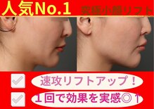 ムーンライズ(moonrise)