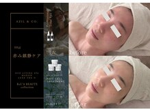 オーヴォ リビングスパ アネックス マノン(OVO LIVING SPA annex MANON)/【施術事例】赤み鎮静ケア