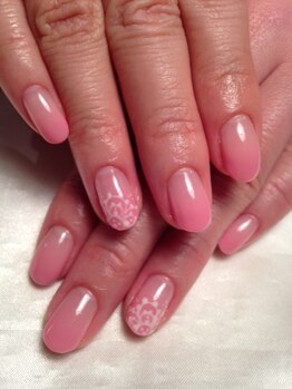 【定額】パラジェル+アート