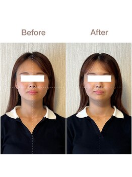 紡(TSUMUGU)/骨格補正スパ