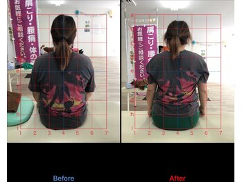 ストレチックス 近江八幡店/ストレッチ ビフォーアフター