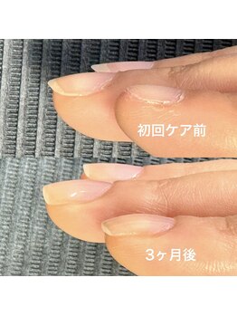 ネイルサロンアンドスクール マルベリー(mulberry)/江南市/自爪育成
