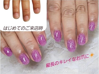 ベアソウル(Bare Soul)の写真