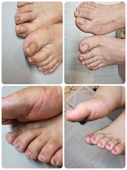 ネイルジュネス(NAIL JEUNESSE)の写真/フットネイルケア(角質ケア込) 10800円