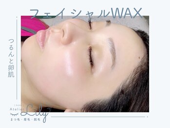 アトリエ リリー(Atelier Lily)の写真/【最新THR光脱毛×WAX】痛みの少ない全身脱毛＆VIO！WAXとのダブル脱毛で即ツルスベ肌へ♪
