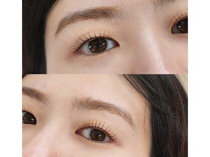ハナナ(hanana)の写真