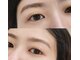 ハナナ(hanana)の写真