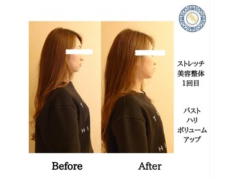 RKY/バストのハリ&ボリュームアップ