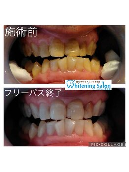 シフォン 豊田店/3週間フリーパス終了のお客様