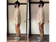 ミントのかべの整体院/姿勢矯正ビフォーアフター