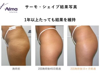 Nビューティー/最新エンダモロジーBODY