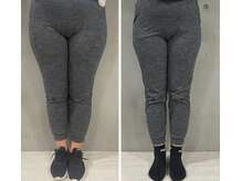 レナセール FUK 福岡店(RENACER FUK)/美脚作り