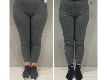 レナセール FUK 福岡店(RENACER FUK)/美脚作り