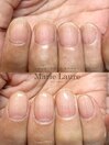 自爪育成/深爪矯正/ネイルケア