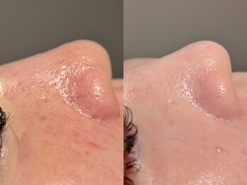 ルーナジェーナ(Luna llena)/