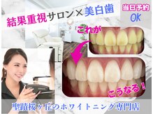 ホワイトニングショップ 多摩店