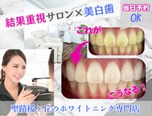 ホワイトニングショップ 多摩店