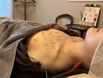 Onはり灸サロンの写真/初回は通常の施術メニューがお得に!バストアップと姿勢・肩こり改善を一緒に叶える美容鍼灸施術をご提供*