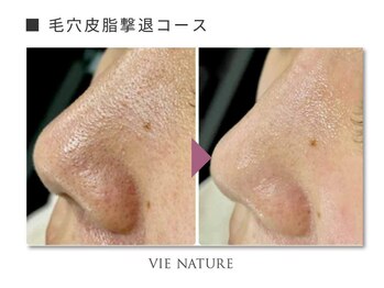 ヴィナチュール(vie nature)/ ■毛穴ケア