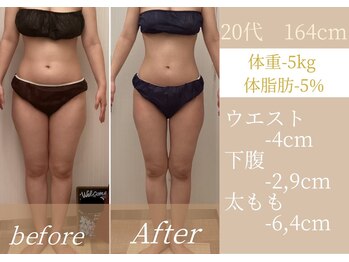 ラ コンシェル 溝の口店/●Before After●【溝の口】