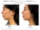 サボラミ(sabor A Mi)の写真