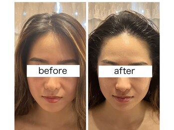 ビューティーサロン リリー(Lily)/