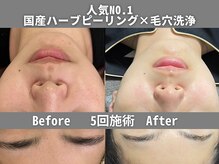 イーラボ 池袋店(e-LABO)の雰囲気（当店人気NO.1ハーブ×毛穴洗浄！コスパ最強/同時施術で効果UP◎）