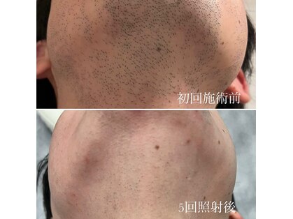 バルダー 原宿 神宮前(BALDER.)の写真