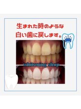 ホワイトニングショップ 葛西店/歯科提携 ホワイトニング専門店